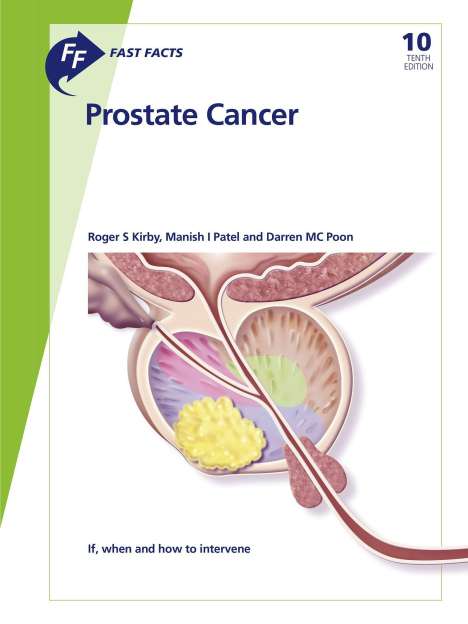 Roger S. Kirby: Kirby, R: Fast Facts: Prostate Cancer, Buch