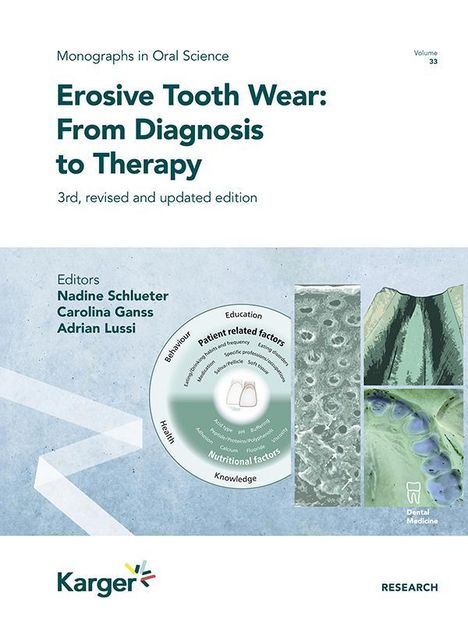 Erosive Tooth Wear, Buch