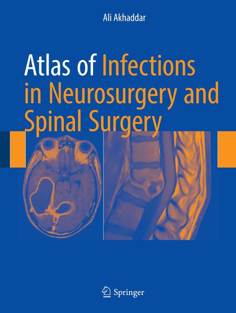 Ali Akhaddar: Atlas of Infections in Neurosurgery and Spinal Surgery, Buch