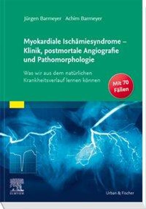 Jürgen Barmeyer: Myokardiale Ischämiesyndrome - Klinik, postmortale Angiografie und Pathomorphologie, Buch