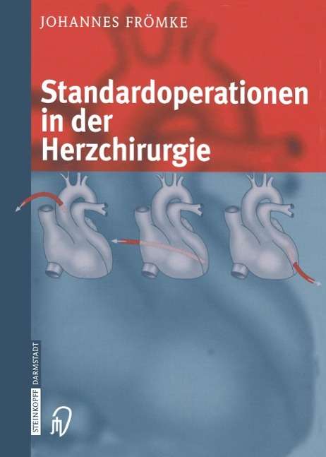Johannes Frömke: Frömke, J: Standardoperationen in der Herzchirurgie, Buch