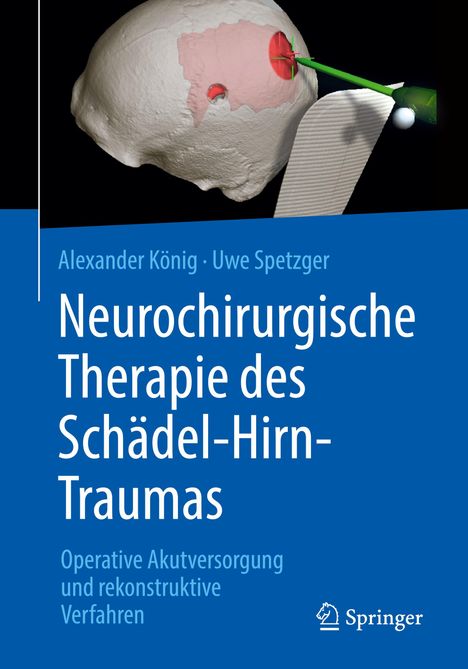 Uwe Spetzger: Neurochirurgische Therapie des Schädel-Hirn-Traumas, Buch