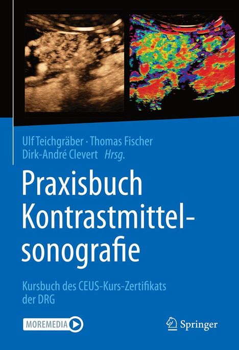 Praxisbuch Kontrastmittelsonografie, Buch