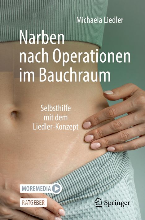 Michaela Liedler: Narben nach Operationen im Bauchraum, Buch