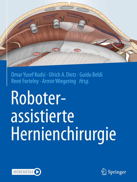 Roboterassistierte Hernienchirurgie, Buch