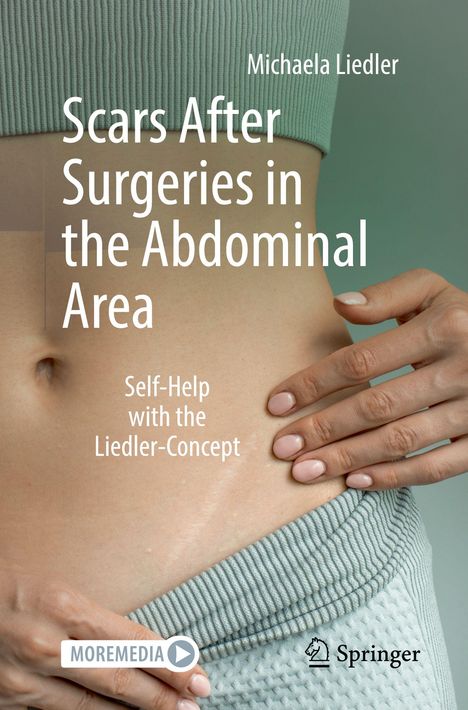 Michaela Liedler: Scars After Surgeries in the Abdominal Area, Buch
