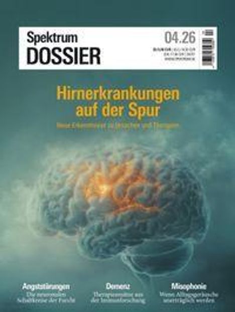 Spektrum Dossier 04.26: "Hirnerkrankungen auf der Spur". Abbildung eines Gehirns, im Hintergrund ein grünlicher Nebel.