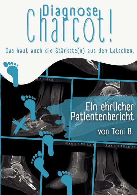 „Diagnose Charcot! Das haut auch die Stärkste(n) aus den Latschen. Ein ehrlicher Patientenbericht von Toni B.“ Blaue Fußabdrücke.