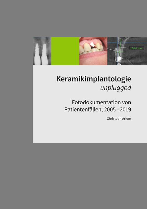 Christoph Arlom: Keramikimplantologie unplugged, Buch