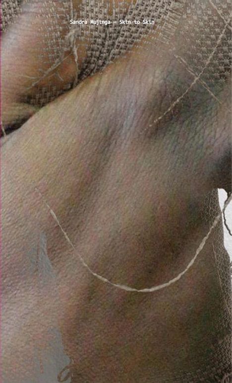 „Sandra Mujinga - Skin to Skin“ steht oben. Eine Nahaufnahme von Haut in unterschiedlichen Texturen.