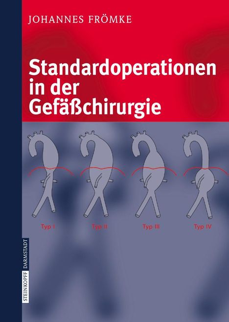 Johannes Frömke: Standardoperationen in der Gefäßchirurgie, Buch