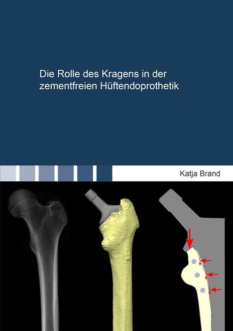 "Die Rolle des Kragens in der zementfreien Hüftendoprothetik" steht oben. Links ist ein Röntgenbild eines Oberschenkelknochens.