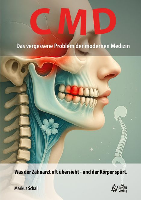 Markus Schall: CMD - Das vergessene Problem der modernen Medizin, Buch