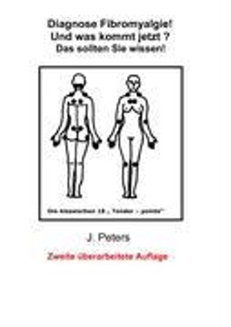 Joachim Peters: Diagnose Fibromyalgie! Und was kommt jetzt?, Buch