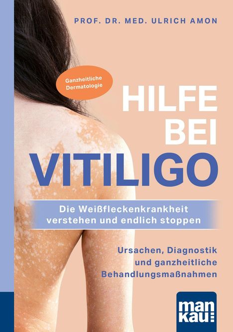 Buchcover: "Hilfe bei Vitiligo" von Prof. Dr. med. Ulrich Amon. Fokus auf Haut mit weißen Flecken.