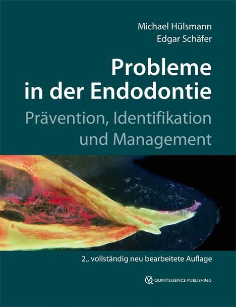 Michael Hülsmann: Probleme in der Endodontie, Buch