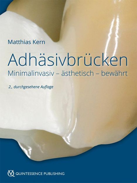 Matthias Kern (1928-2014): Adhäsivbrücken, Buch