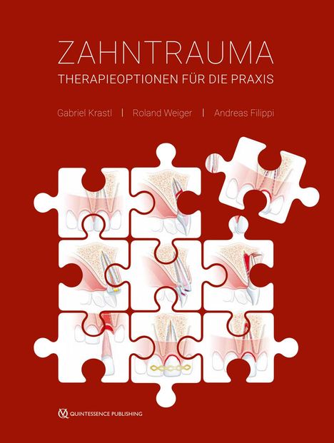 Gabriel Krastl: Zahntrauma, Buch