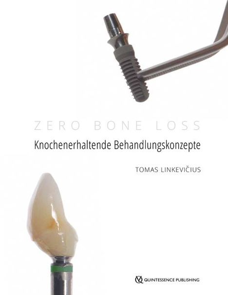 Tomas Linkevicius: Zero Bone Loss: Knochenerhaltende Behandlungskonzepte, Buch