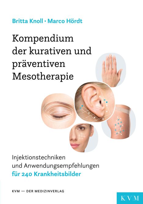 Britta Knoll: Kompendium der kurativen und präventiven Mesotherapie, Buch