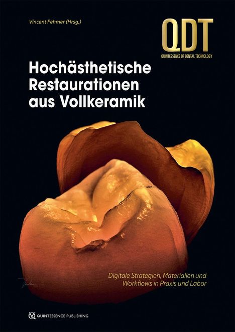 Hochästhetische Restaurationen aus Vollkeramik, Buch