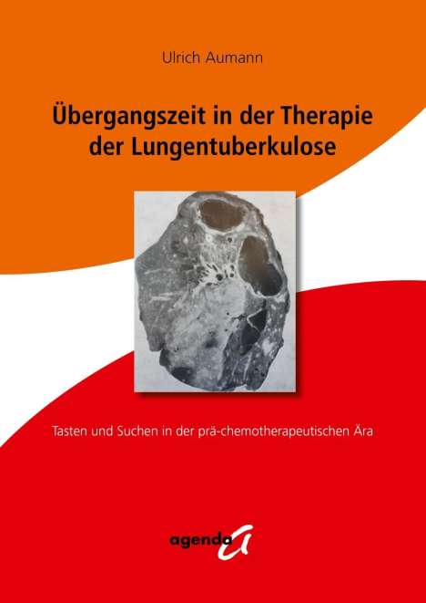 Ulrich Aumann: Übergangszeit in der Therapie der Lungentuberkulose, Buch