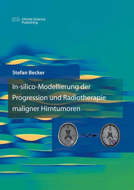 Stefan Becker: In-silico-Modellierung der Progression und Radiotherapie maligner Hirntumoren, Buch