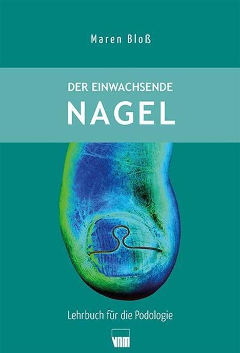 Maren Bloß: Der eingewachsenen Nagel, Buch