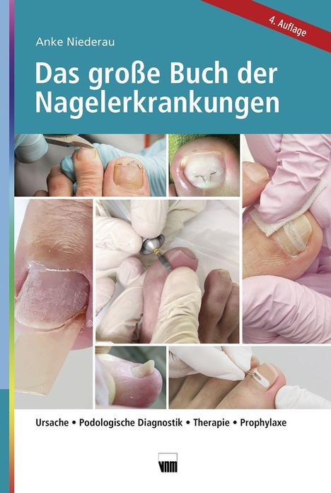 Anke Niederau: Niederau, A: große Buch der Nagelerkrankungen, Buch
