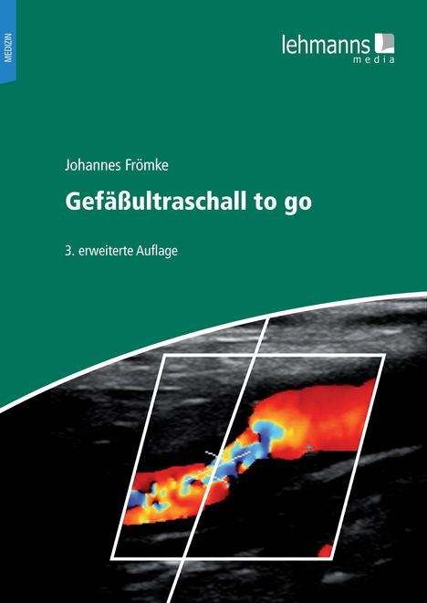 Johannes Frömke: Gefäßultraschall to go, Buch