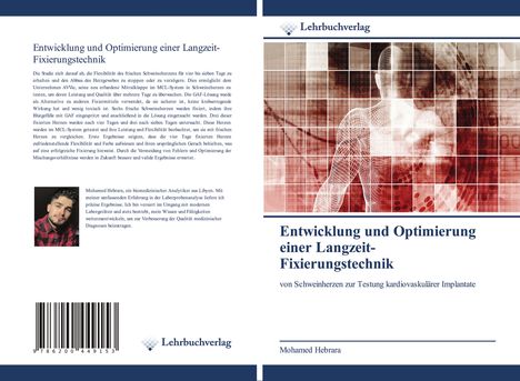 Mohamed Hebrara: Entwicklung und Optimierung einer Langzeit- Fixierungstechnik, Buch