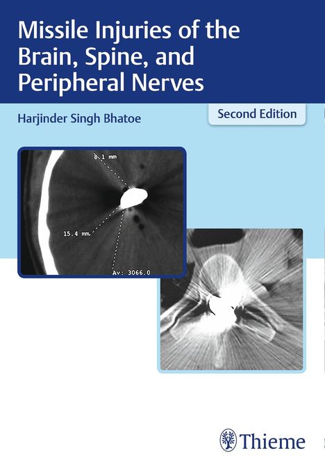 Harjinder S Bhatoe: Missile Injuries of the Brain, Spine, and Peripheral Nerves, Buch