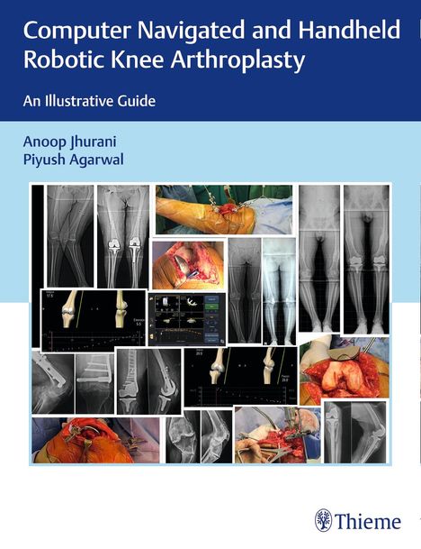 Anoop Jhurani: Computer Navigated and Handheld Robotic Knee Arthroplasty, Buch