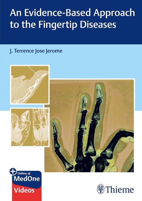 An Evidence-Based Approach to the Fingertip Diseases, Buch