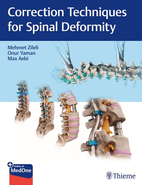 Correction Techniques for Spinal Deformity, 1 Buch und 1 Diverse