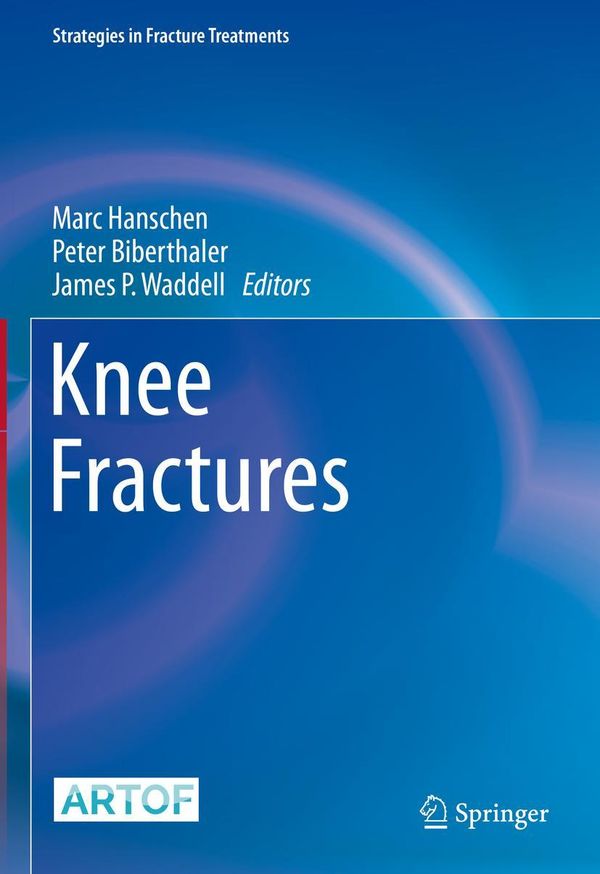Knee Fractures (Buch)