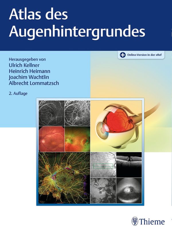 Atlas des Augenhintergrundes (Buch)