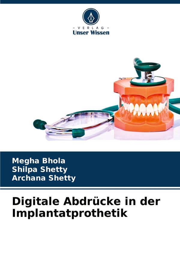 Digitale Abdrücke in der Implantatprothetik - Megha Bhola (Buch)