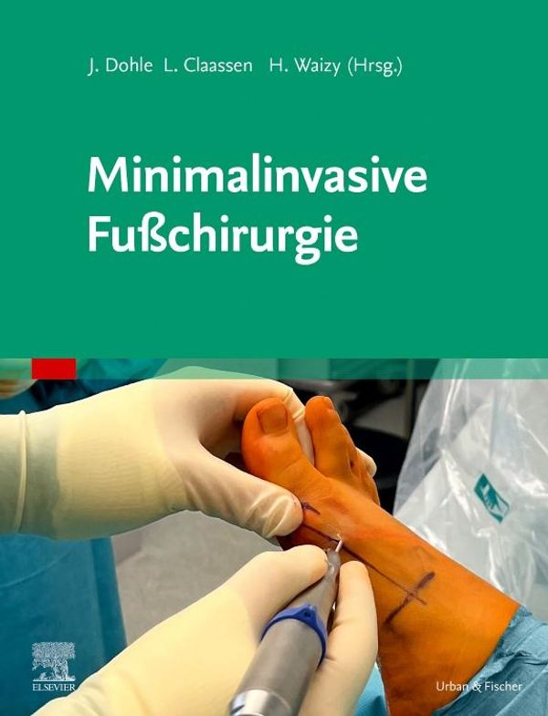 Minimalinvasive Fußchirurgie (Buch)