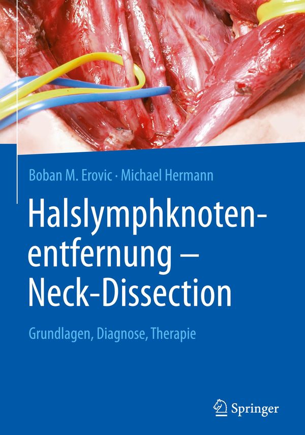 Halslymphknotenentfernung - Neck-Dissection - Boban M. Erovic (Buch)