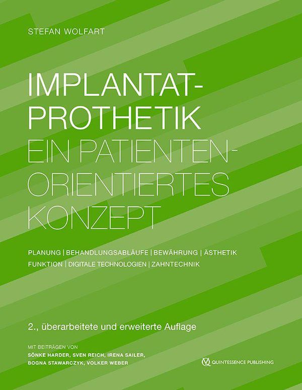 Implantatprothetik - Stefan Wolfart (Buch)