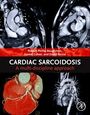 : Cardiac Sarcoidosis, Buch