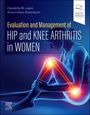 : Evaluation and Management of Hip and Knee Arthritis in Women, Buch