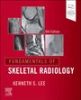 Kenneth S Lee: Helms - Fundamentals of Skeletal Ra, Buch