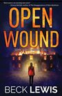 Beck Lewis: Open Wound, Buch