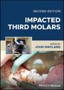 : Impacted Third Molars, Buch