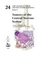 Cynthia E. Hawkins: Tumors of the Central Nervous System, Buch