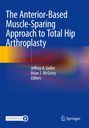 : The Anterior-Based Muscle-Sparing Approach to Total Hip Arthroplasty, Buch