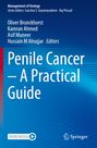 : Penile Cancer ¿ A Practical Guide, Buch