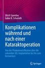 Ulrich Spandau: Komplikationen während und nach einer Kataraktoperation, Buch